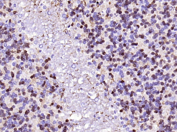 CALB2 Recombinant Rabbit Monoclonal Antibody