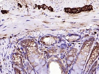 CALB2 Recombinant Rabbit Monoclonal Antibody