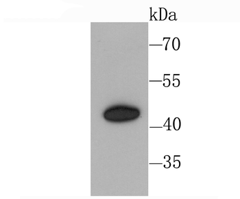 CXCR3 Recombinant Rabbit Monoclonal Antibody