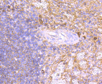 Human IgM Recombinant Rabbit Monoclonal Antibody