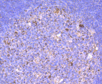Human IgM Recombinant Rabbit Monoclonal Antibody