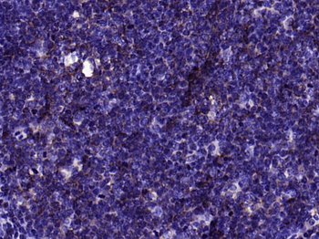 Human IgM Recombinant Rabbit Monoclonal Antibody