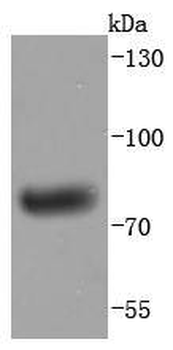 Human IgM Recombinant Rabbit Monoclonal Antibody