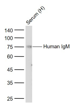 Human IgM Recombinant Rabbit Monoclonal Antibody