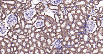 Sodium Potassium ATPase Mouse Monoclonal Antibody