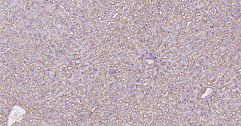 Sodium Potassium ATPase Mouse Monoclonal Antibody