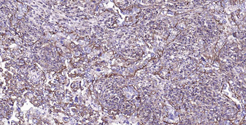 Sodium Potassium ATPase Mouse Monoclonal Antibody