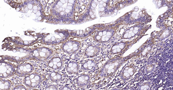 Sodium Potassium ATPase Mouse Monoclonal Antibody