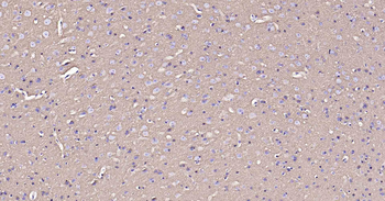 Sodium Potassium ATPase Mouse Monoclonal Antibody