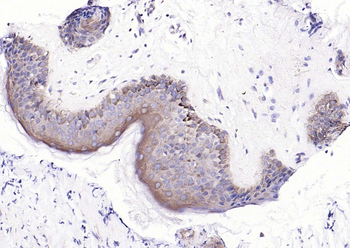 Fatty Acid Synthase Recombinant Rabbit Monoclonal Antibody
