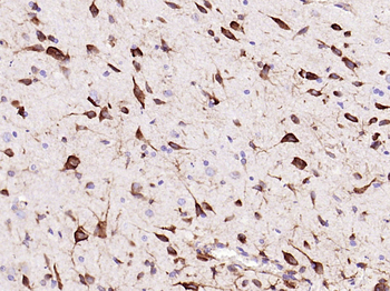 ATF4 Recombinant Rabbit Monoclonal Antibody