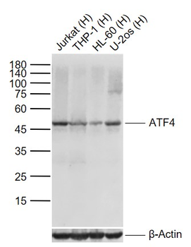 ATF4 Recombinant Rabbit Monoclonal Antibody