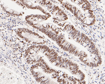 ATF4 Recombinant Rabbit Monoclonal Antibody