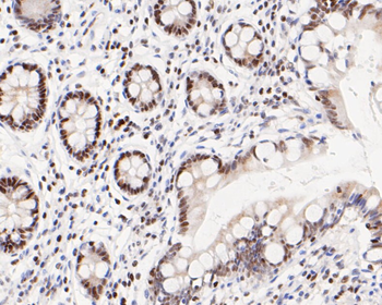 ATF4 Recombinant Rabbit Monoclonal Antibody
