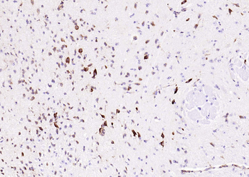 ATF4 Recombinant Rabbit Monoclonal Antibody