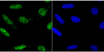 Mad2L1 Recombinant Rabbit Monoclonal Antibody