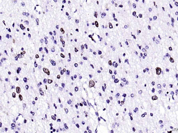 Lamin B1 Recombinant Rabbit Monoclonal Antibody