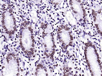 Lamin B1 Recombinant Rabbit Monoclonal Antibody