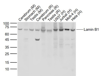 Lamin B1 Recombinant Rabbit Monoclonal Antibody