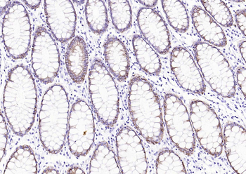 Cytokeratin 8 Recombinant Rabbit Monoclonal Antibody