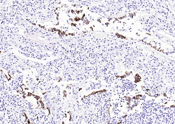 Cytokeratin 8 Recombinant Rabbit Monoclonal Antibody
