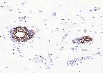 Cytokeratin 8 Recombinant Rabbit Monoclonal Antibody