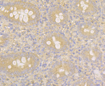 MARK3 Recombinant Rabbit Monoclonal Antibody