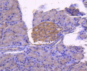 Calnexin Recombinant Rabbit Monoclonal Antibody