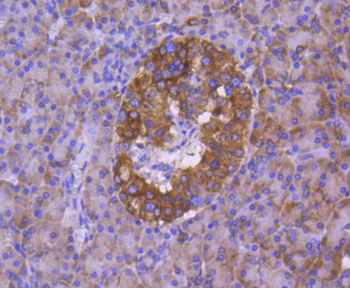 Calnexin Recombinant Rabbit Monoclonal Antibody