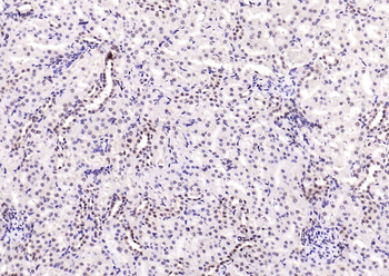 NADPH oxidase 4 Recombinant Rabbit Monoclonal Antibody