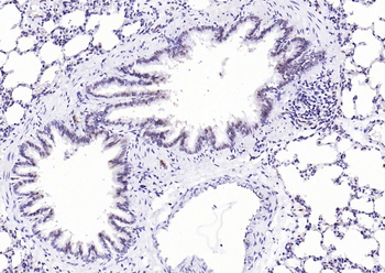 NADPH oxidase 4 Recombinant Rabbit Monoclonal Antibody