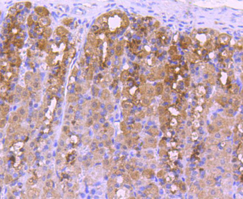 NADPH oxidase 4 Recombinant Rabbit Monoclonal Antibody