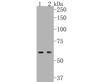 NADPH oxidase 4 Recombinant Rabbit Monoclonal Antibody