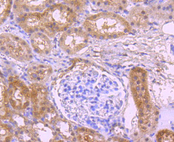 NADPH oxidase 4 Recombinant Rabbit Monoclonal Antibody