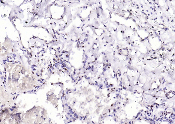 NADPH oxidase 4 Recombinant Rabbit Monoclonal Antibody