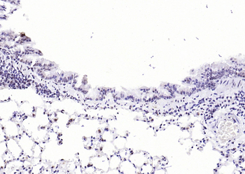 NADPH oxidase 4 Recombinant Rabbit Monoclonal Antibody