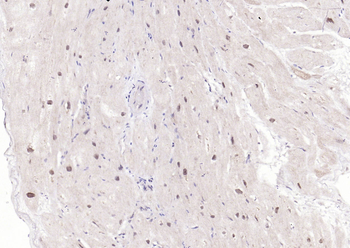 TSG101 Recombinant Rabbit Monoclonal Antibody