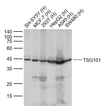 TSG101 Recombinant Rabbit Monoclonal Antibody