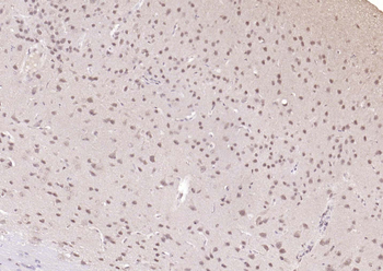 TSG101 Recombinant Rabbit Monoclonal Antibody