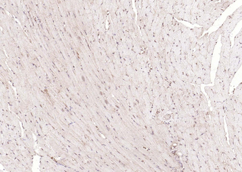 TSG101 Recombinant Rabbit Monoclonal Antibody
