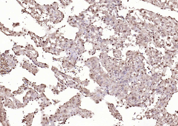 TSG101 Recombinant Rabbit Monoclonal Antibody