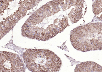 TSG101 Recombinant Rabbit Monoclonal Antibody