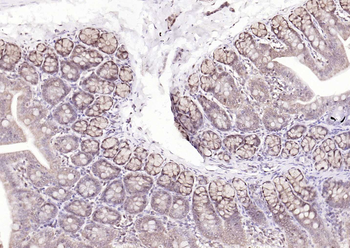 TSG101 Recombinant Rabbit Monoclonal Antibody