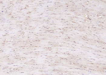 TSG101 Recombinant Rabbit Monoclonal Antibody