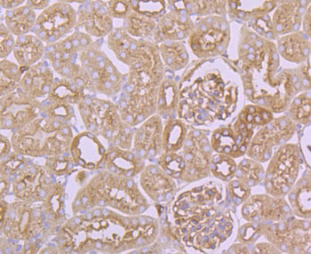 ARP3 Recombinant Rabbit Monoclonal Antibody
