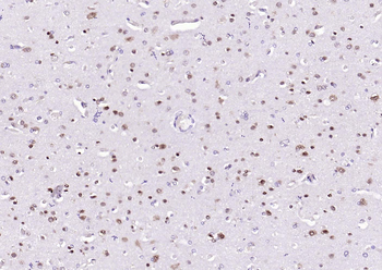 CSNK2B/CK II beta Recombinant Rabbit Monoclonal Antibody