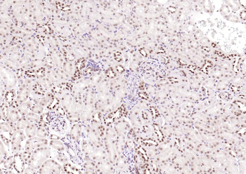 CSNK2B/CK II beta Recombinant Rabbit Monoclonal Antibody