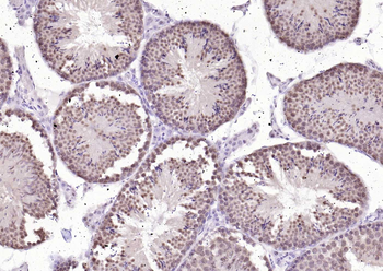 CSNK2B/CK II beta Recombinant Rabbit Monoclonal Antibody