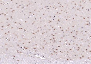 CSNK2B/CK II beta Recombinant Rabbit Monoclonal Antibody