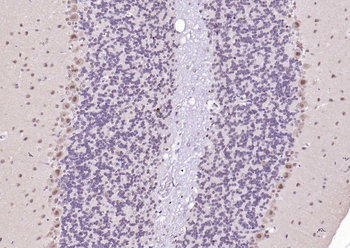 CSNK2B/CK II beta Recombinant Rabbit Monoclonal Antibody
